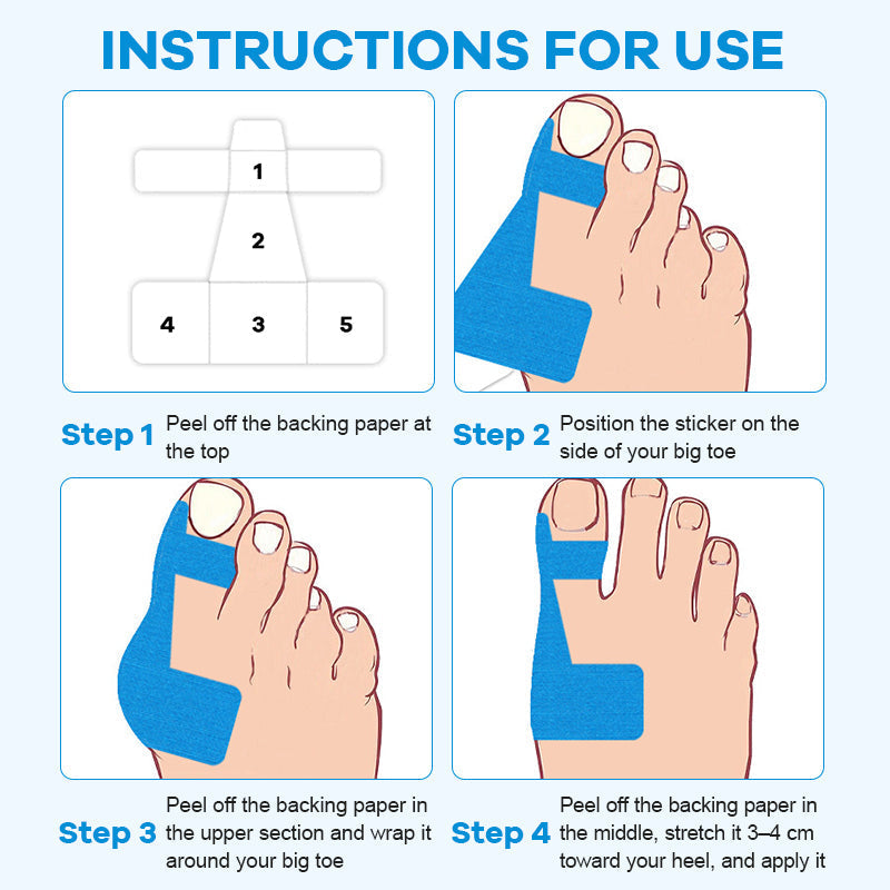 🎉Summer Sale - 49% OFF - Bunion Relief Toe Correction Wrap