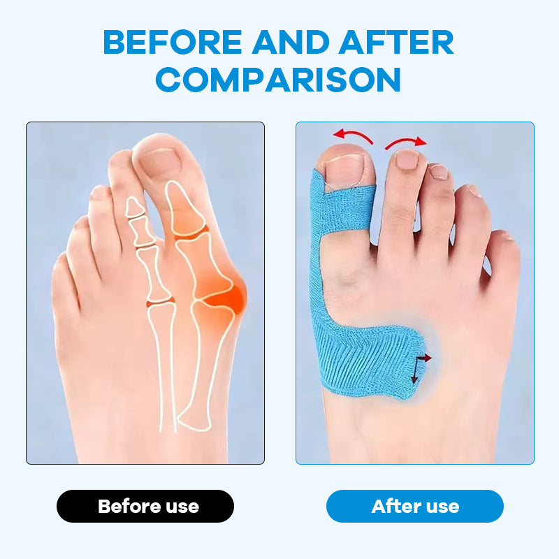 🎉Summer Sale - 49% OFF - Bunion Relief Toe Correction Wrap
